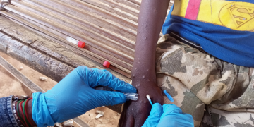 Mpox