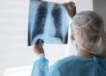 hidrogênio molecular aliado contra doenças pulmonares