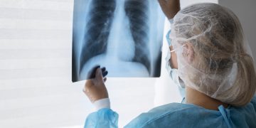 hidrogênio molecular aliado contra doenças pulmonares