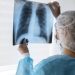 hidrogênio molecular aliado contra doenças pulmonares