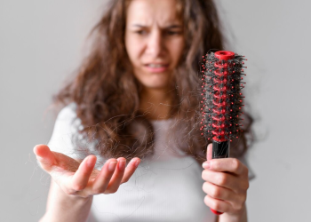 queda de cabelo