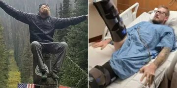 Homem tem as duas pernas amputadas depois de queimar dedo da mão em frigideira