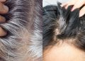 Adeus aos fios brancos: ‘Fiz essa desintoxicação e meu cabelo ficou preto’