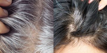 Adeus aos fios brancos: ‘Fiz essa desintoxicação e meu cabelo ficou preto’