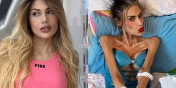 Influencer morre aos 30 anos pesando apenas 22 kg