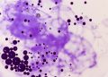 Toxoplasma gondii