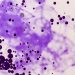 Toxoplasma gondii