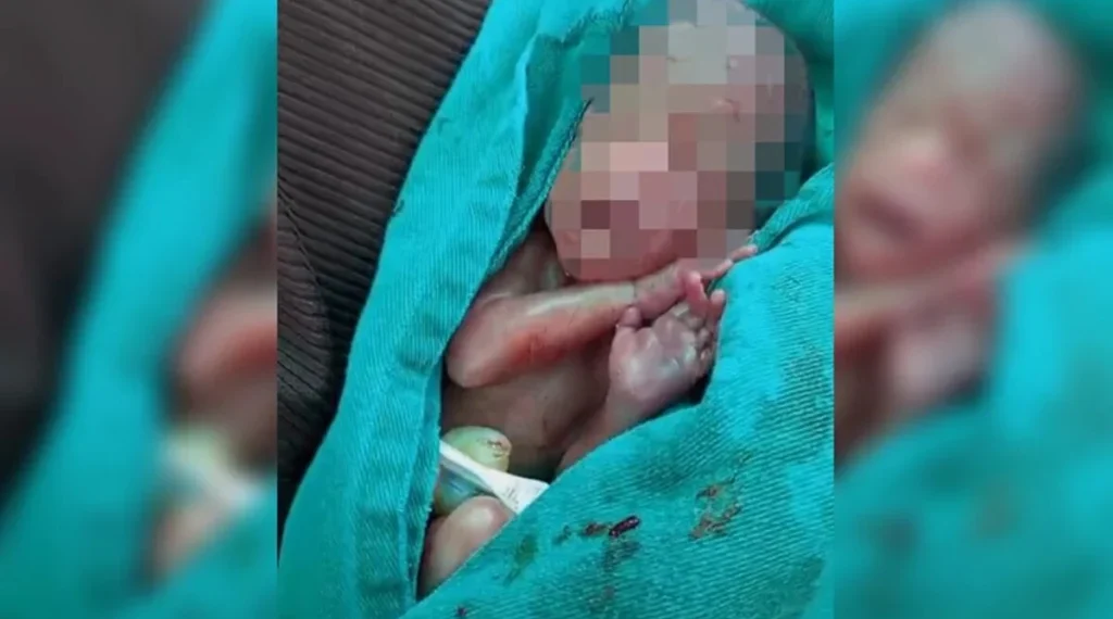 bebê dado como morto