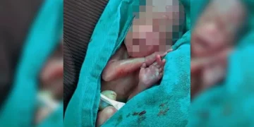 bebê dado como morto
