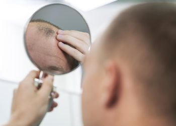 CALVÍCIE DEPRESSÃO