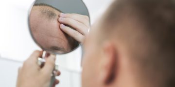 CALVÍCIE DEPRESSÃO