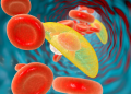 toxoplamose