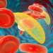 toxoplamose