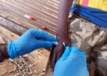 Mpox