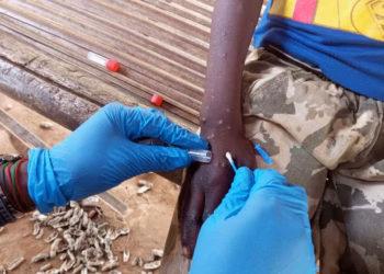 Mpox