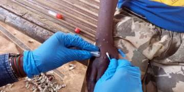Mpox