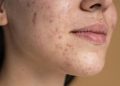 O corpo manda sinais antes do colapso: entenda os sintomas da inflamação crônica